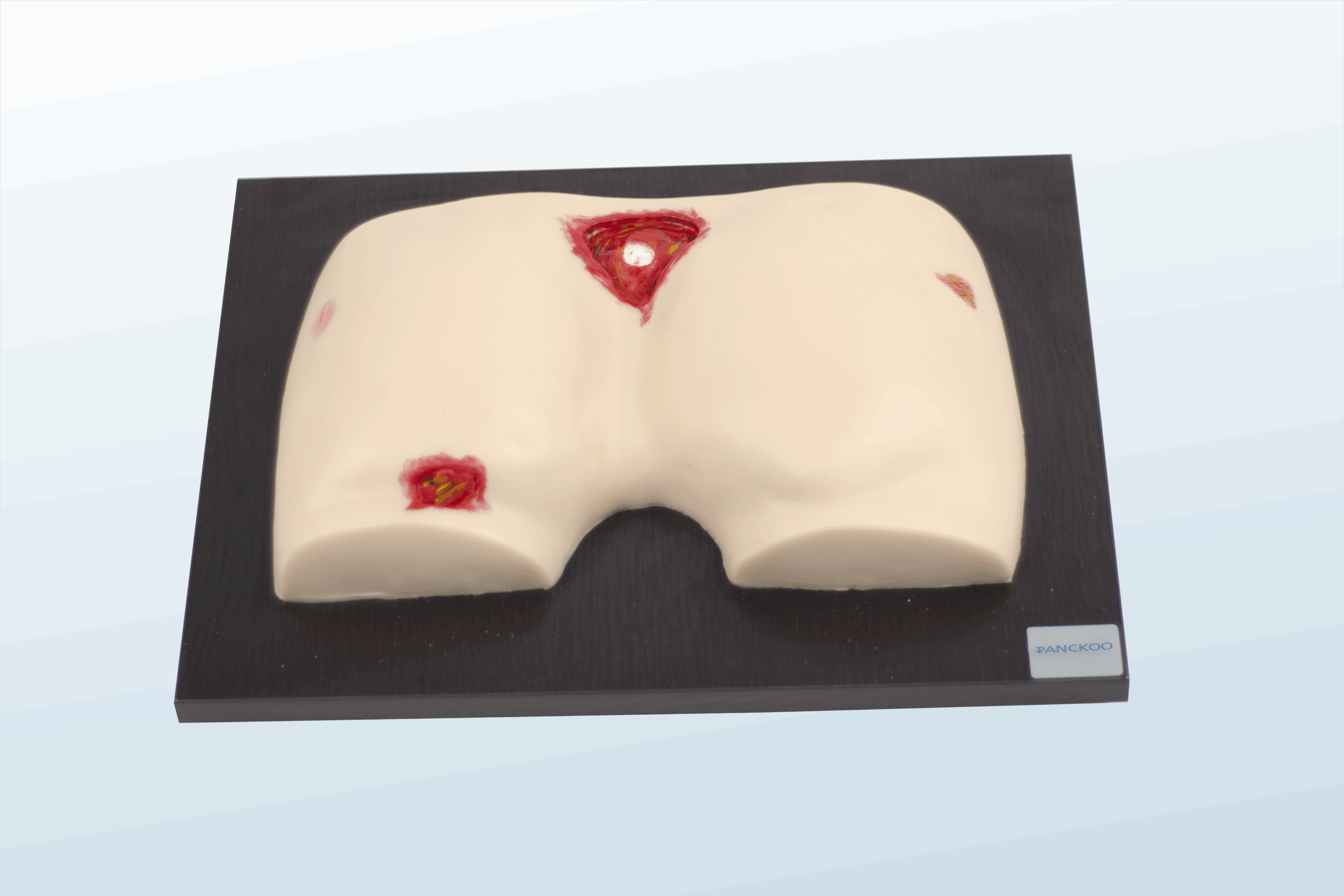 FREE SHIPPING:  Pressure Ulcer/Bedsore Model