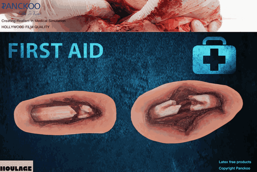 FREE SHIPPING:  Sheet Fractures