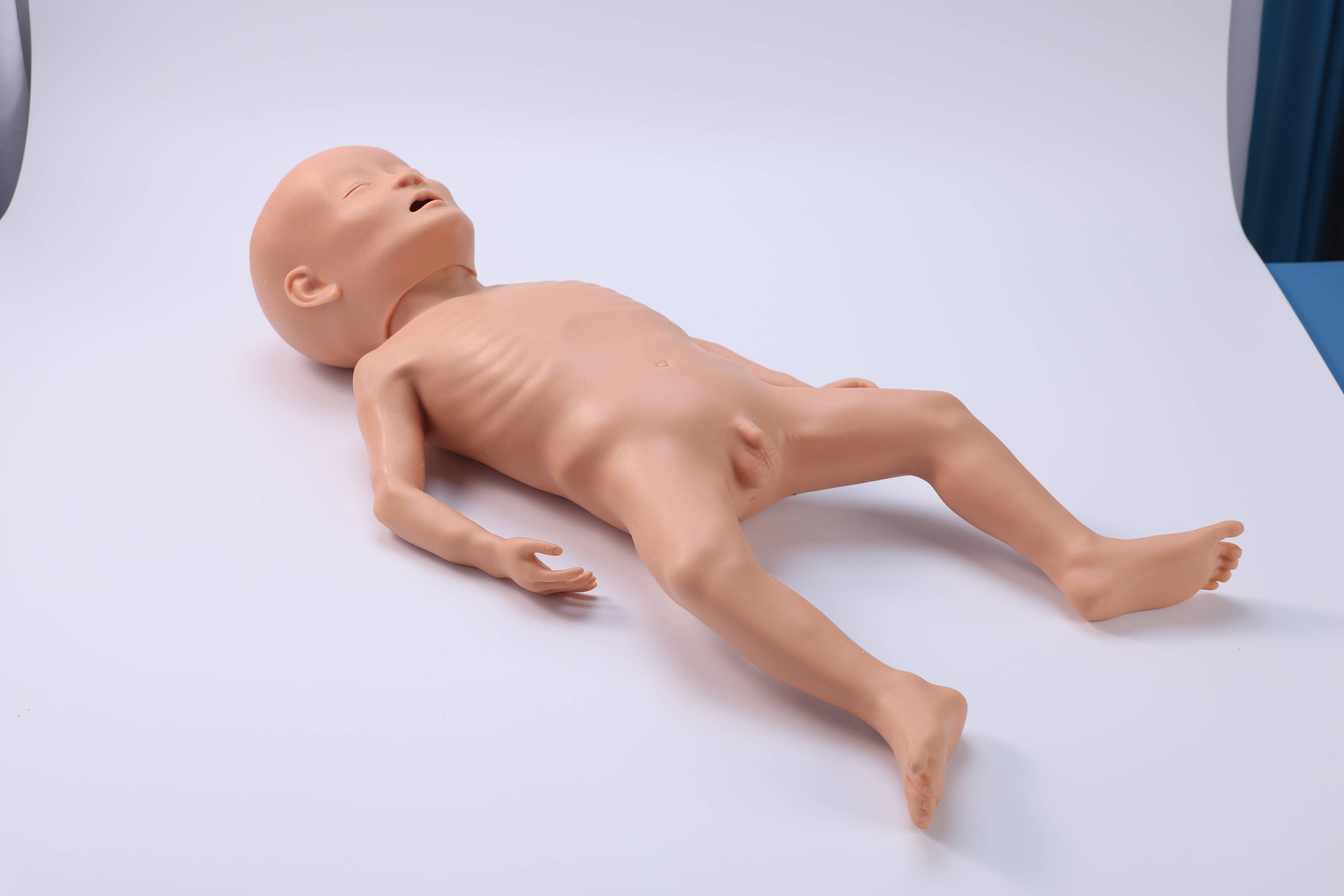 Infant Malnutrition Model